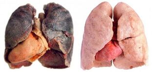 lungs of smokers and healthy